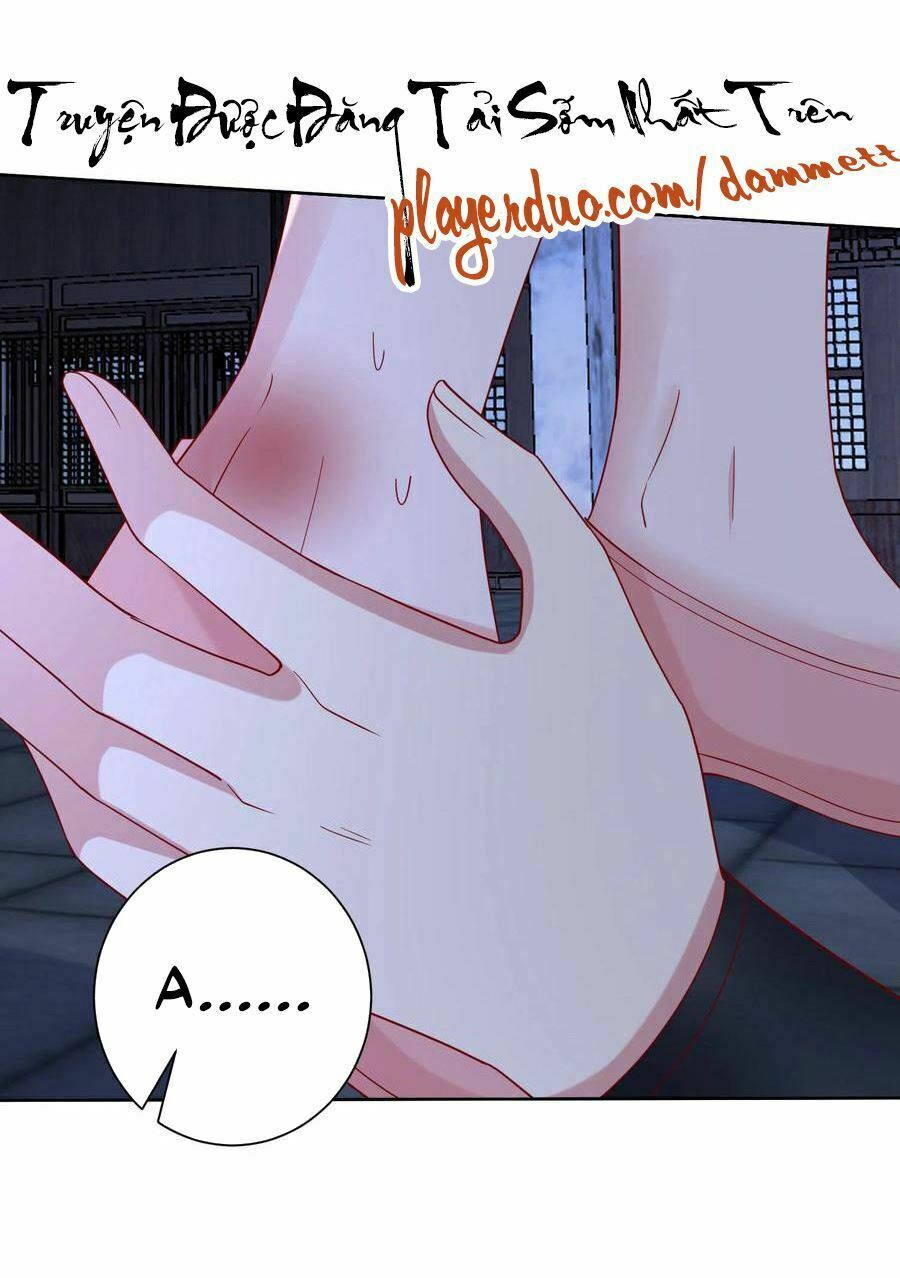 Độc Y Đích Nữ: Chapter 170