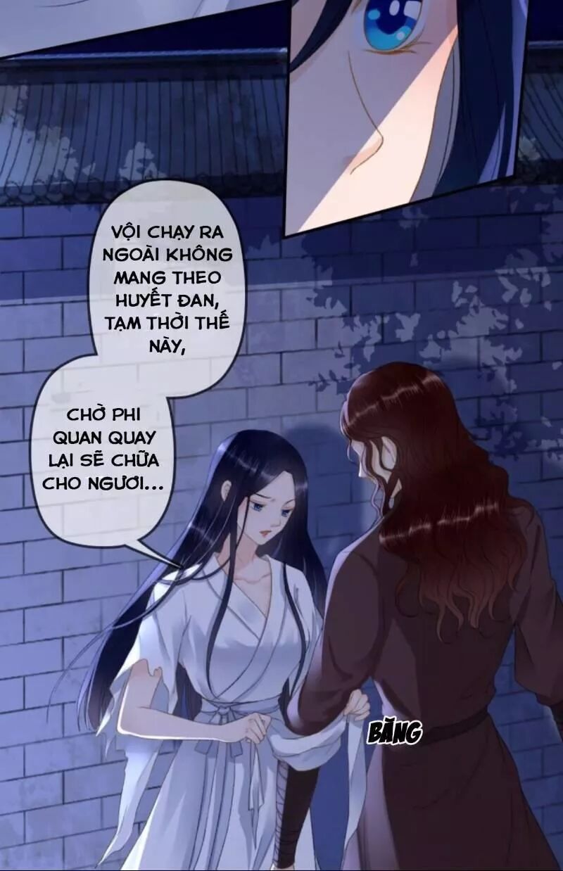Sủng Phi Của Vương: Chapter 147
